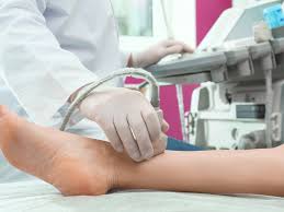 Arterial duplex Doppler ultrasound